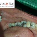 용산치과기공소 이미지