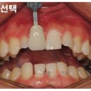 아트치과기공소 이미지