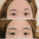 앤비비 이미지