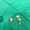 사랑니를부탁해구강악안면외과치과의원 이미지