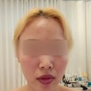 부곡맛고을1길 | 김천 피부관리 디자인라인스튜디오 천방케어 솔직후기