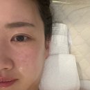 쏘굿홈케어 | 강동구에스테틱 루미에르에스테틱, 홍조피부 상일동피부관리 솔직후기