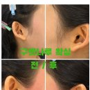호이 스킨케어 | 인계동 구레나룻 왁싱 문결 왁싱 후기