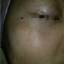 에코아일린 | 정자역 에코하루 에스테틱 피부미백관리 추천해요.