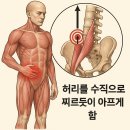 허리통증의 핵심, 장요근을 주목하라! 이미지