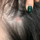 씨유 성남모란월드점 | 성남 아이리나 붙임머리｜두피 통증으로 붙임머리 제거한 모란 붙임머리 전문샵 후기(셀프 제거 실패..)