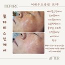 오광케어 이미지