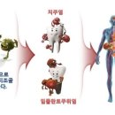 비앤비서울치과 네이버블로그
