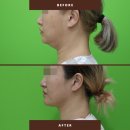 로이성형외과의원 이미지