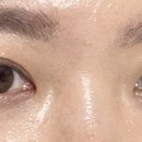 1001안경위드렌즈 이미지