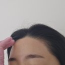 희헤어라인 이미지