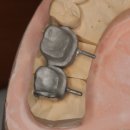 민치아치과기공소 이미지