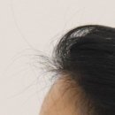 비아프의원 네이버블로그