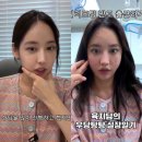래퍼 육지담성형외과 상담실장 변신 시술 후기
