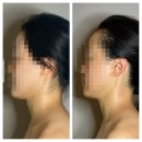 홍성축산업협동조합 | 홍성윤곽관리 엘라인 이지다 숨결클렌징과 작아진얼굴후기