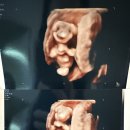 문산부인과 | 12주차 기록 _ 1차기형아 검사 후기(송파포유문산부인과 1차 기형아검사 가격)