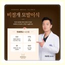 1354 | 55세 남자 비절개모발이식 M자탈모 1354모낭 9개월차 수술후기
