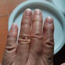 어머니의 마음 | 어머니의 손가락 통증 해결 후기