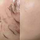 다다스킨케어 | 범계 스킨플래닝 '다다뷰티엔왁싱'에서 물광 피부 리셋! 웨딩촬영 전 예신관리 필수 코스 후기