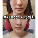 나나비펫 | 청담지방분해주사 다이어트 얼굴제로팻주사 3회차 후기
