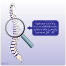 흉추(Thoracic Spine)의 해부학적 이해 이미지