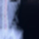 올본신경외과의원 | 흑석 '올본 신경외과의원'에서 신경차단술 씨암(C-ARM) 주사로 허리 통증 치료 후기