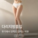 유주왕외과의원 | 다리지방흡입 후기에서 만족도 갈리는 이유, 지방보다 중요한 건 따로 있습니다