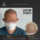 노스탈