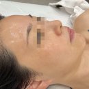 10 | 사천피부관리 잘하는 곳 에비뉴에스테틱! 에비뉴시그니처관리 후기