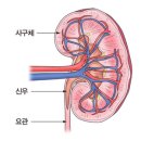 신증후성 출혈열(Hemorrhagic fever with renal syndrome) 이미지