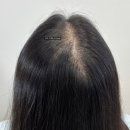 정수리 | 김포구래동 웨딩촬영 전 정수리문신후기