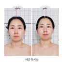 경포천로 | 군산 피부관리 에스뷰티 더윤곽 V핏 관리 후기