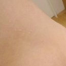 안산리본한의원 | 기존의 살 빼는 것과 차별화된 쉽고 지속적인 배곧다이어트한의원에서 체지방 타파