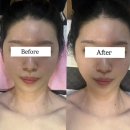 (주)포이에마 | (수원영통)포이에마피부샵 3V테라피(윤곽, 비대칭, 탄력)/물방울 초음파 관리/웨딩관리/위치/영업시간/주차