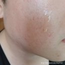 웰그린라이프 | 리얼갈바닉 이온토라이프 클리앳 피부관리기 사용후기~