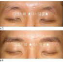 예쁜야시