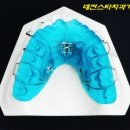 스타치과기공소 이미지