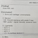 신기의료기 수영점 | 원판형 반월상 연골 파열 2