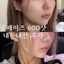 청담필즈성형외과의원 | 쿨페이즈 600샷 허쉬성형외과 내 돈 내산 솔직 후기
