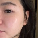 안락2동-4 | 레오아에스테틱 후기, 동래피부관리 &amp; 부산트러블관리로 피부자신감 되찾기