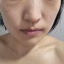 [동탄피부관리 동탄영천동피부관리] 애플페이스SKIN&amp;BODY 수분케어 만족후기