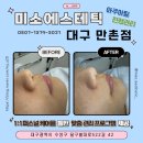 미소에스테틱 - 강남구 남부순환로365길 49 | [대구 만촌] 수성구에스테틱 인생 첫 아쿠아필 미소에스테틱에서 관리 후기