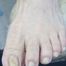 1431 | 청주발관리로 엄마 발 고민 덜어낸 풋케어 후기