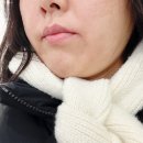 예쁜미인성형외과의원 | 강남역성형외과 l 온다리프팅 얼굴지방분해주사 볼살 이중턱 변화 후기