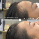더뷰티이진영 | 대전 신탄진 두피문신 한 차원 높은 디자인