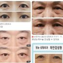 서울 동대문구 성형외과 잘하는 곳, 유명한 곳, 리뷰 인기순위 TOP 7