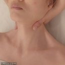 아름다운피부 | 울산 피부관리 윤곽관리 리프팅 아름다운 차이 V-Lift360