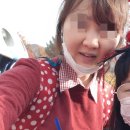 유투성형외과의원 | 자연스럽고 절개없는 코프팅! 유투성형외과!