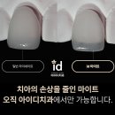네츄럴치과기공소 이미지