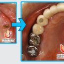 수플란트치과병원 이미지